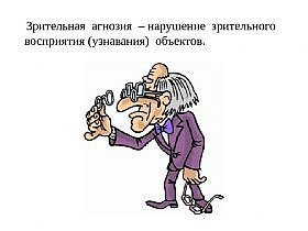 Агнозия
